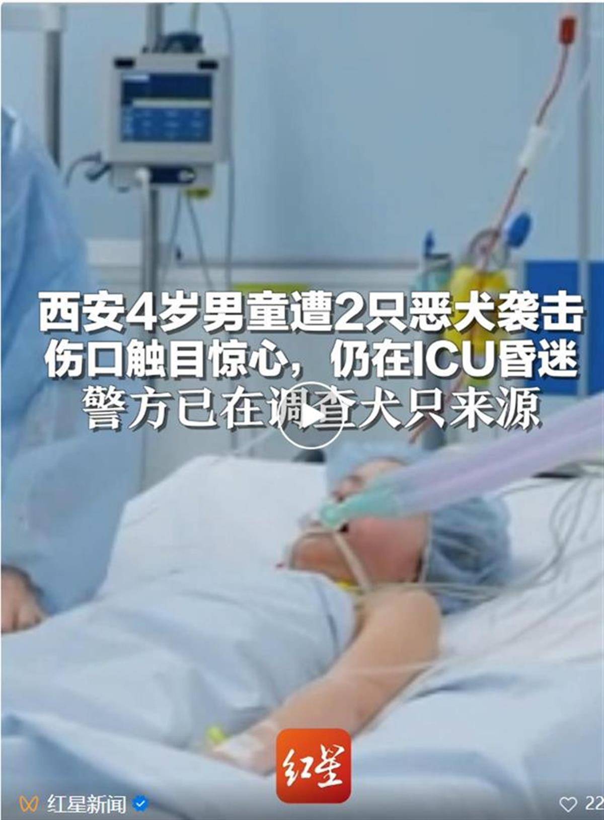 4歲男童遭惡犬襲擊住進(jìn)ICU，狗咬人為何就管不住？