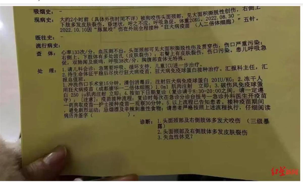 4歲男童遭惡犬襲擊住進(jìn)ICU，狗咬人為何就管不??？
