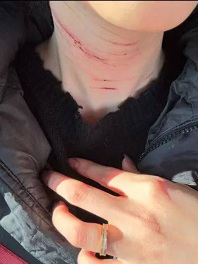 前男友公開金賽綸自殘照，稱她的死與金秀賢無關(guān)