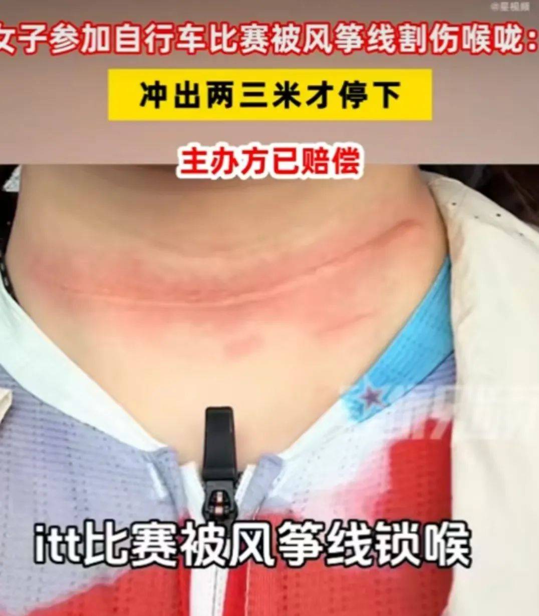 騎友在成都環(huán)城綠道險(xiǎn)遭“割頭”！春季騎行，警惕空中“致命風(fēng)箏線”