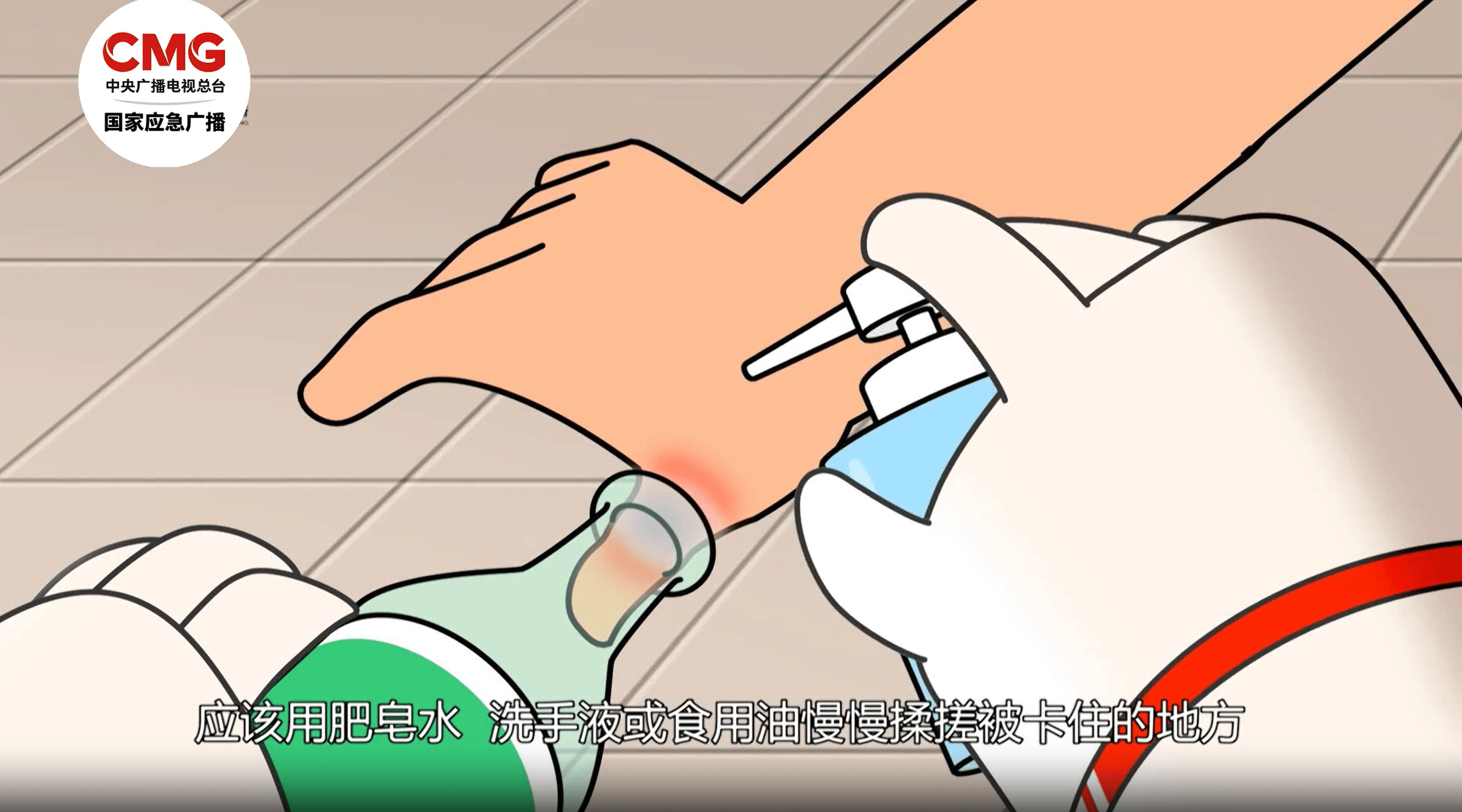 男子昏迷數(shù)日無(wú)人知竟是被卡在家中 居家意外傷害這樣防范