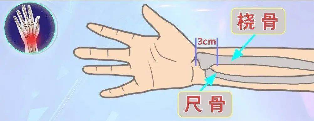 男子昏迷數(shù)日無(wú)人知竟是被卡在家中 居家意外傷害這樣防范