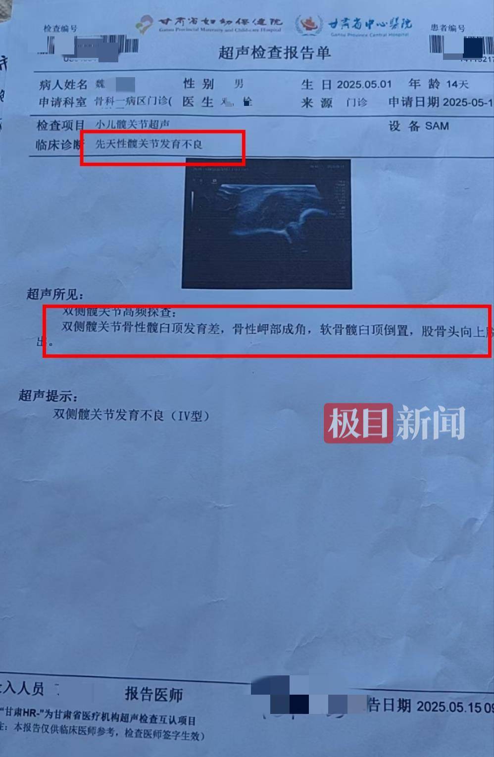 二胎出生查出先天性病癥或落下殘疾，殘疾父母稱醫(yī)院產(chǎn)檢漏檢、未盡告知義務(wù)，醫(yī)院及醫(yī)調(diào)委回應(yīng)