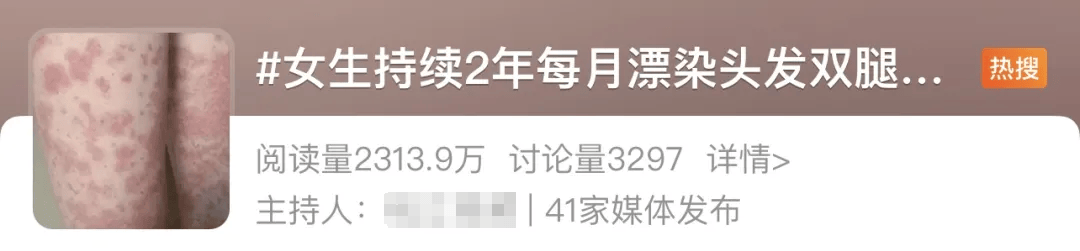 女生每月漂染頭發(fā)，全身長(zhǎng)滿紫斑！這些美發(fā)方式可能會(huì)致癌！
