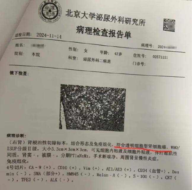 女律師十年體檢未查出癌癥，愛康國賓發(fā)布情況說明