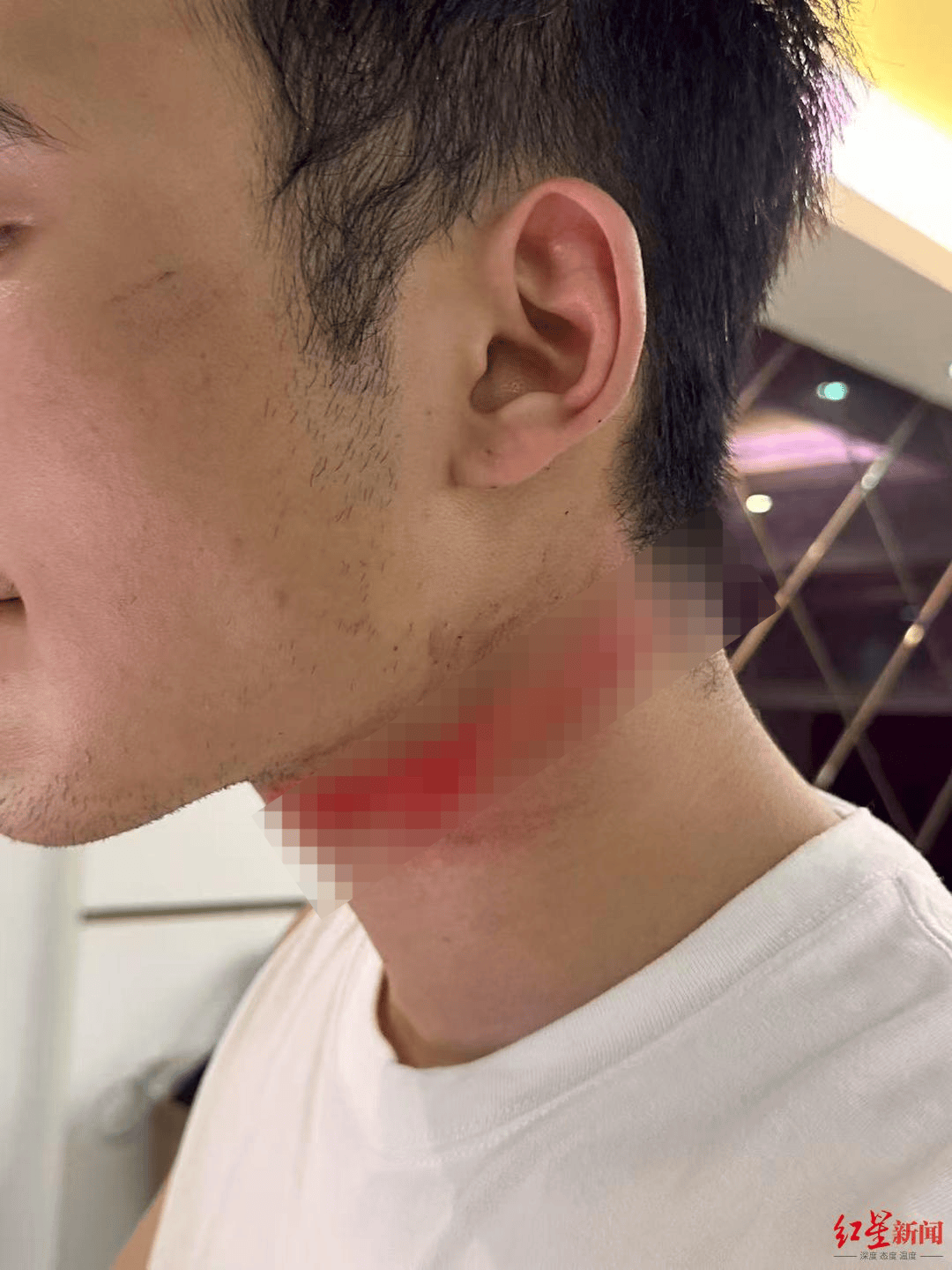 男主播騎車載女友回家被路邊掉落網(wǎng)線勒傷脖子，索賠3萬(wàn)陷僵局 律師解讀該誰(shuí)賠