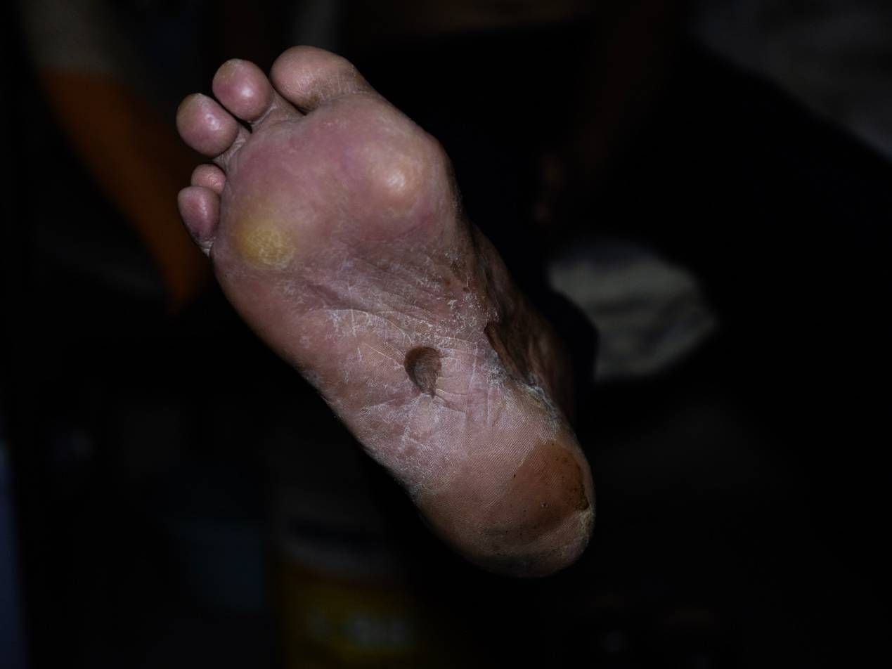 他們擠在8元一晚的旅店 幾百人搶一個(gè)活